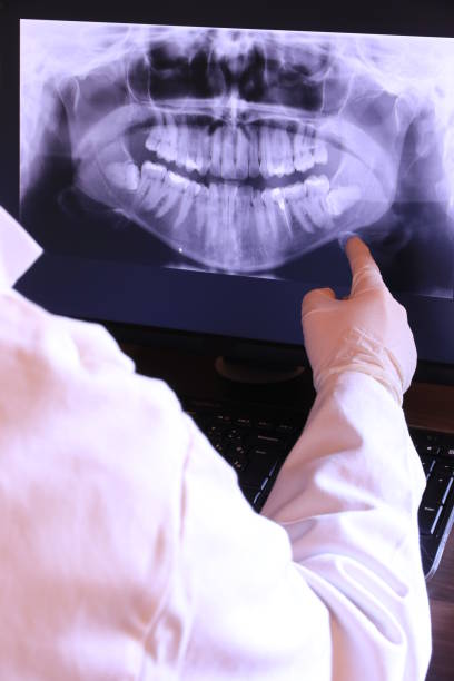 Best Emergency Dental Surgery in Cape St Claire, MD